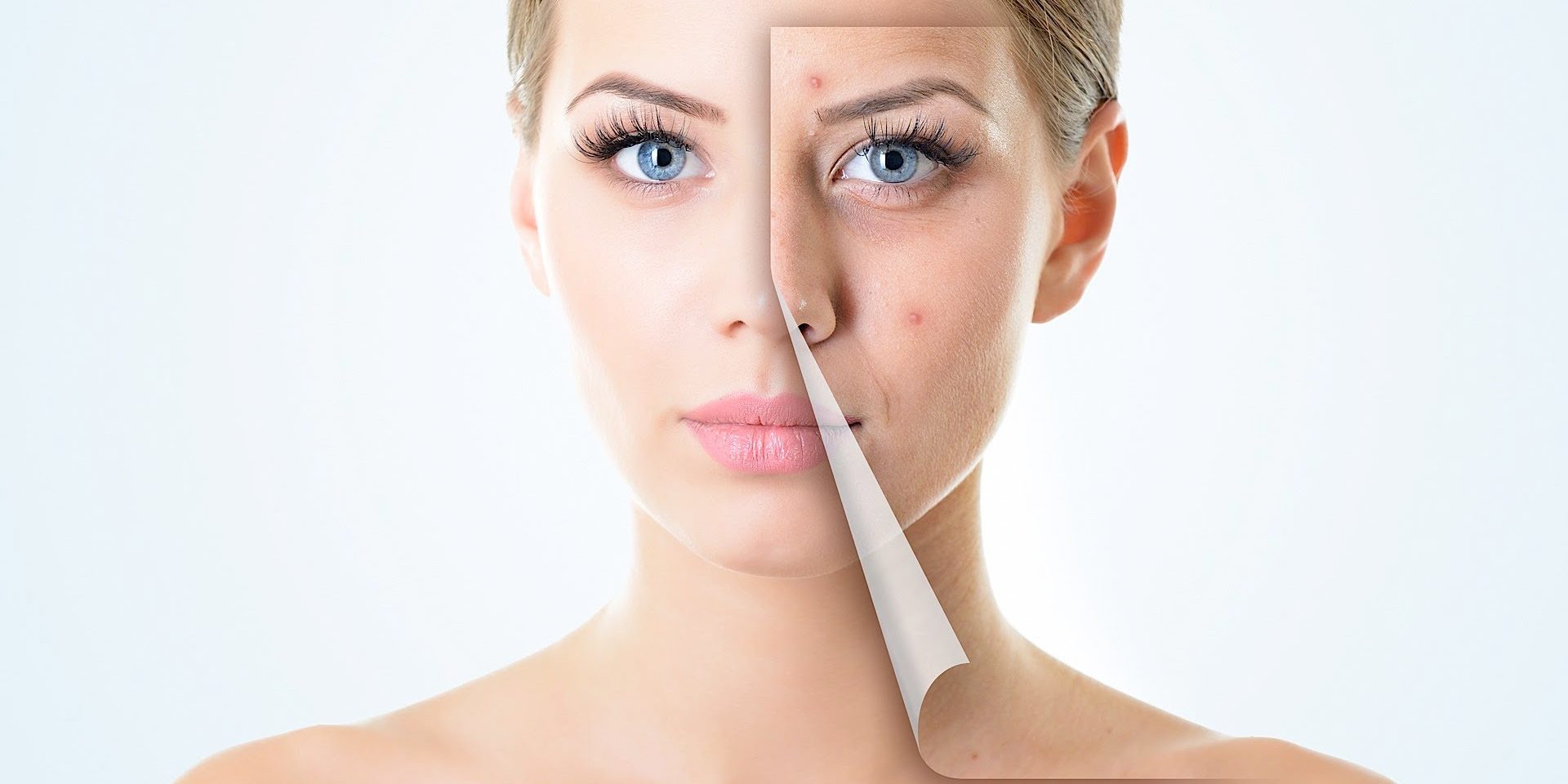 Risultati prima e dopo